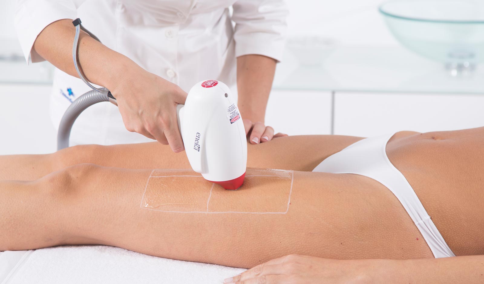 laser-treatment