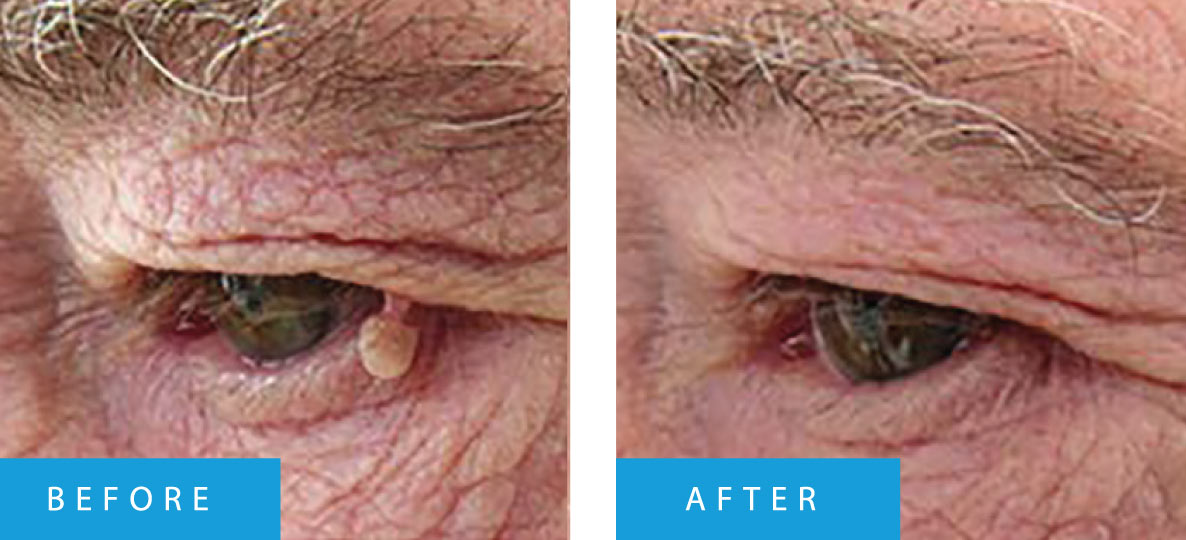 before-after-01