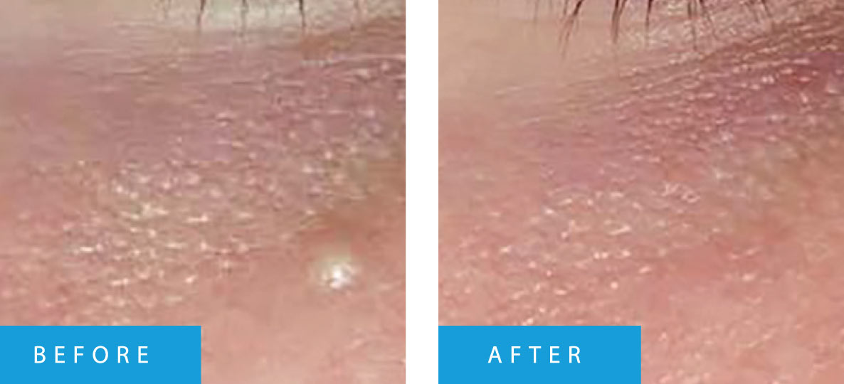 before-after-02
