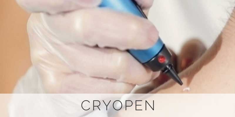 Button-CryoPen