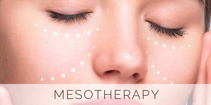 Button-Mesotherapy