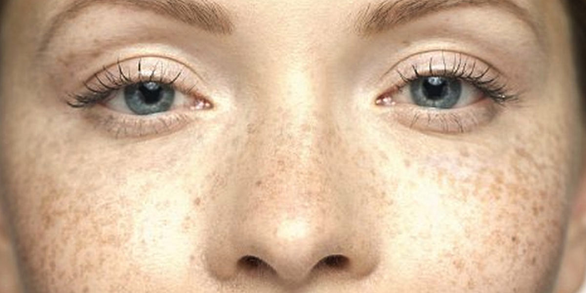 Top-Skin-Toning